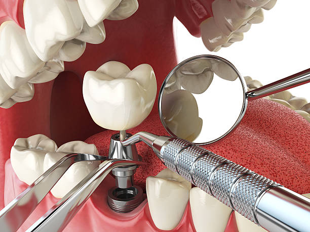 Best Walk-In Emergency Dental Services in Bald Kno, AR